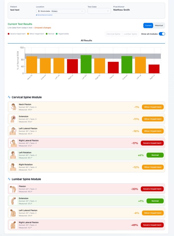 MotionIQ spinal range-of-motion results dashboard (sample test data)
