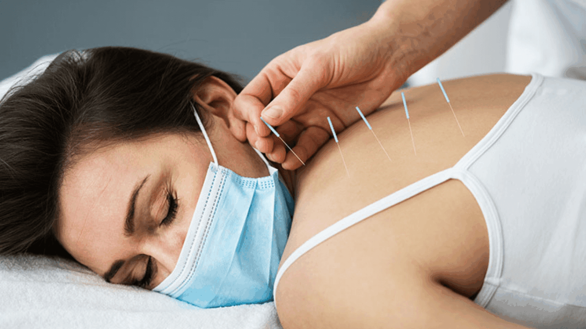 How Dry Needling Helps Relieve Muscle Pain: Physiotherapy Insights from Sunshine Coast Experts